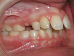 3_before